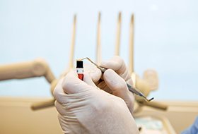 A dentist working with a special composite resin