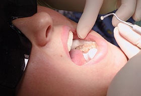 A dentist about to treat a patient’s teeth